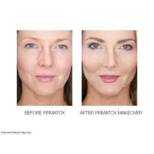 Firmatox T3.0 Triple Tightening Face Serum Mini