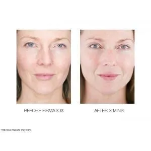 Firmatox T3.0 Triple Tightening Face Serum Mini